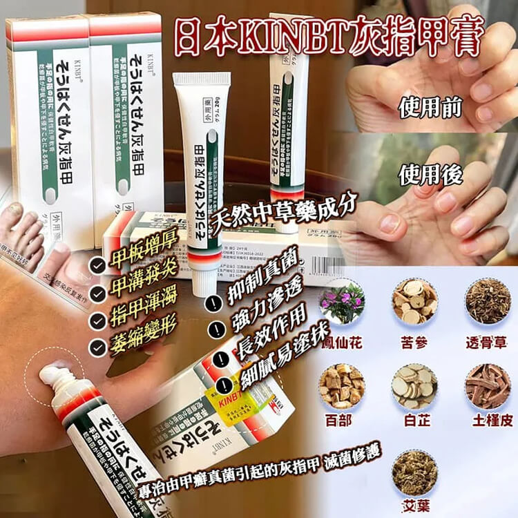 kinbt灰指甲膏1781784076648406.jpg kinbt灰指甲膏
